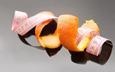 Quando la dieta non funziona